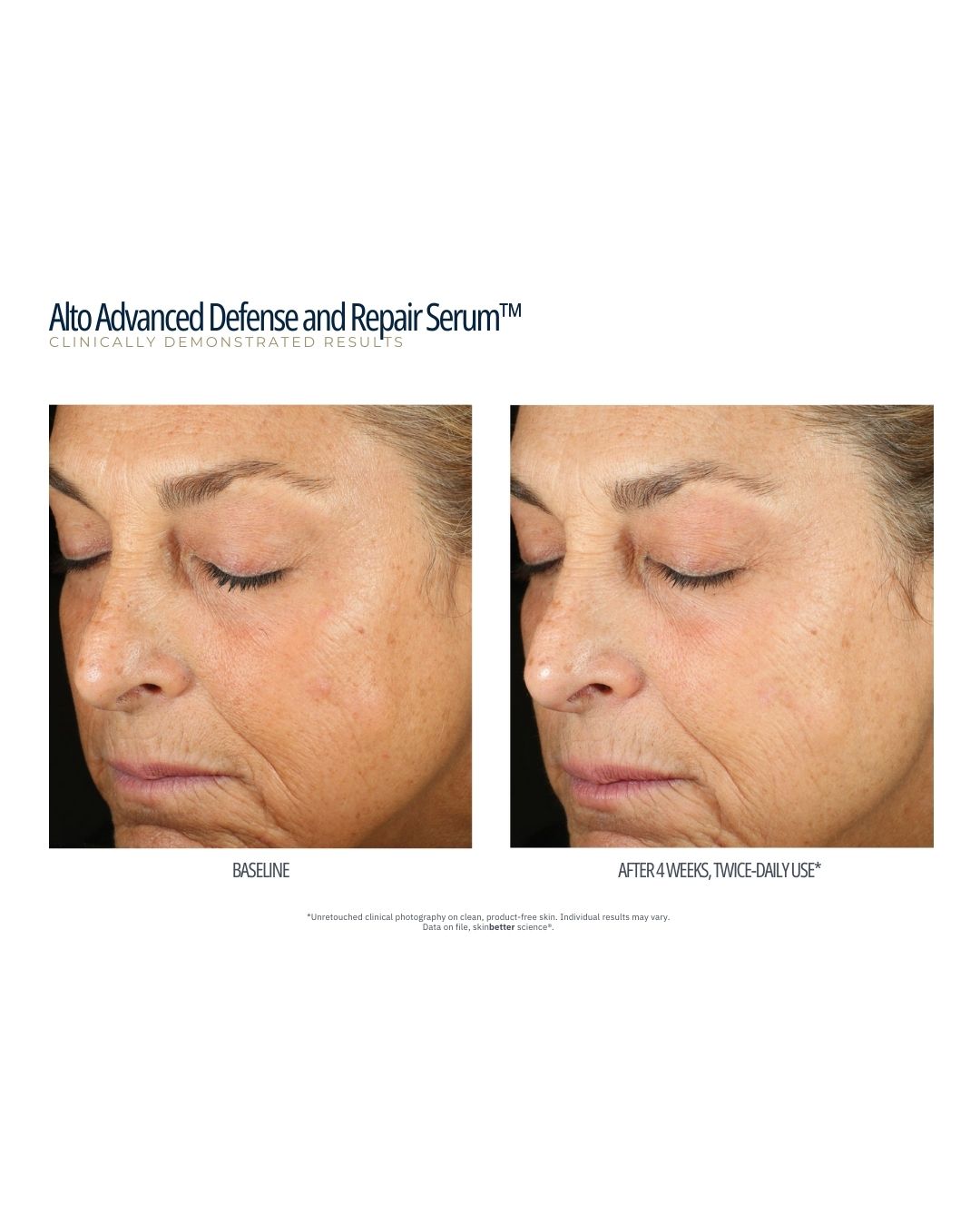 SkinBetter Science Alto Advanced Defense & Repair Serum