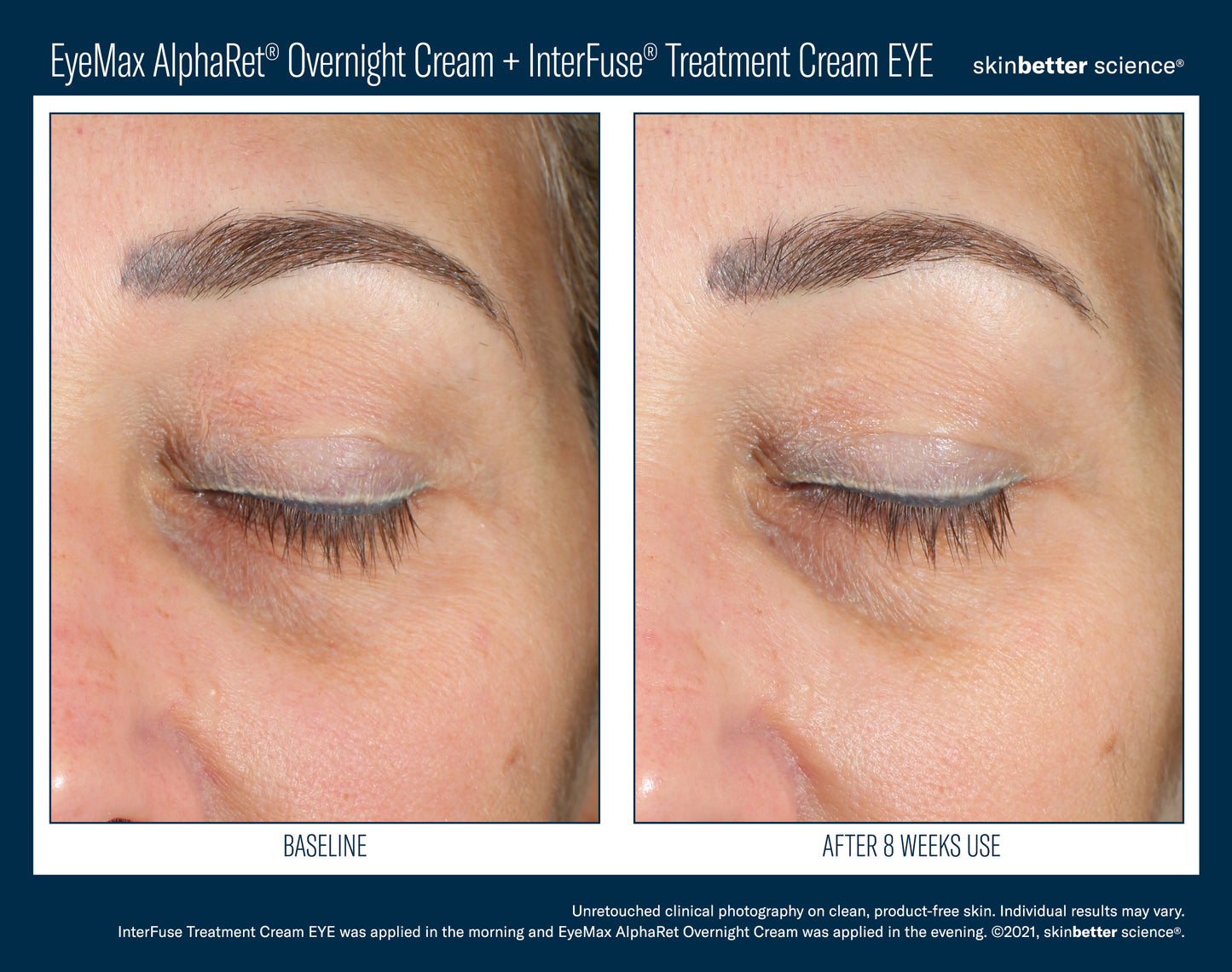 Skinbetter Science® EyeMax™ AlphaRet® Overnight EYE Cream