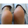 Footlogix Very Dry Skin Formula