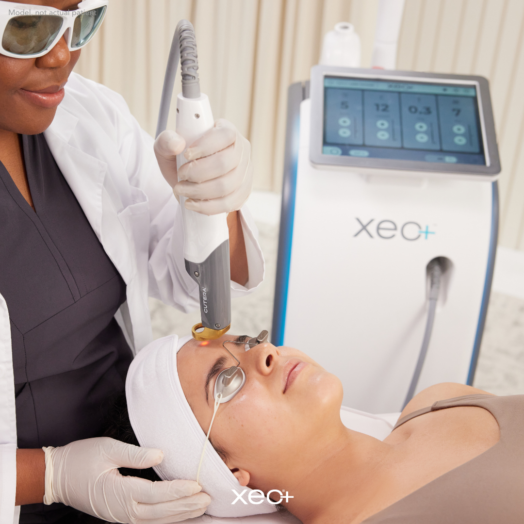 Cutera 2D Facial- Face only