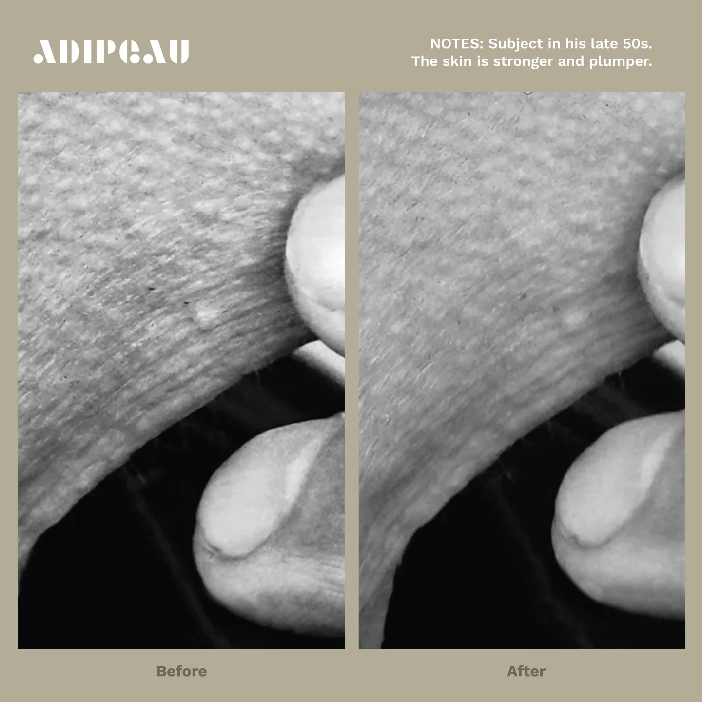 ADIPEAU  bundle 150 ml tube of Strength Gel & 60 ml tube of Volume Cream.