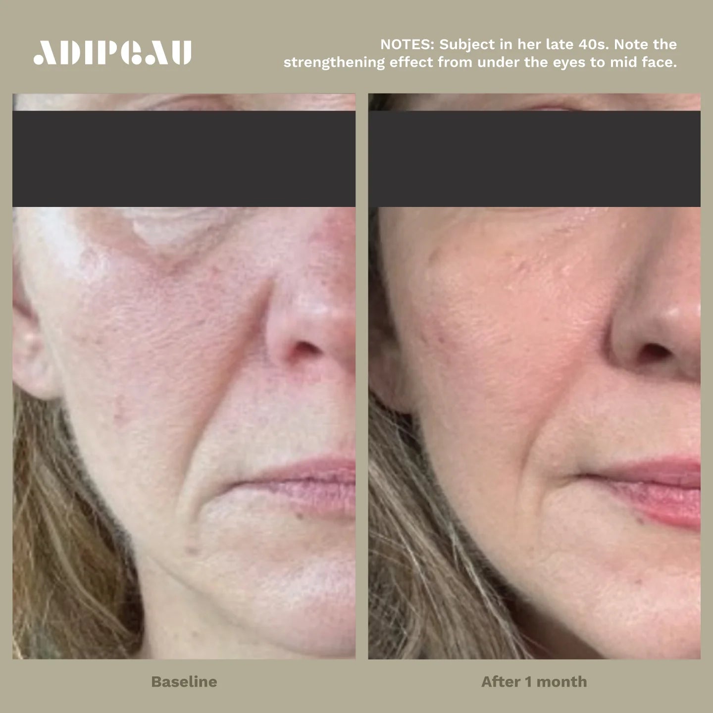 ADIPEAU  bundle 150 ml tube of Strength Gel & 60 ml tube of Volume Cream.