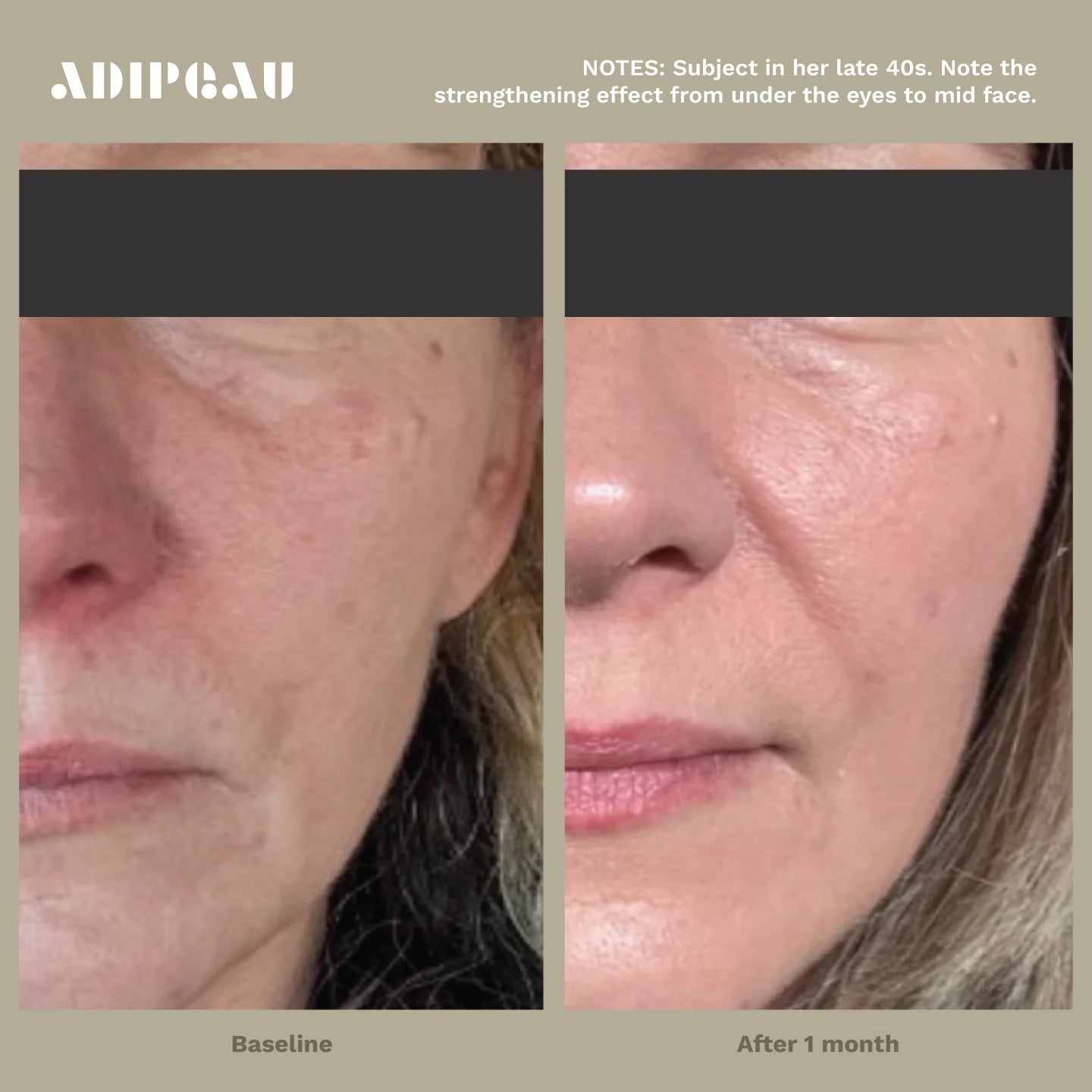 ADIPEAU  bundle 150 ml tube of Strength Gel & 60 ml tube of Volume Cream.