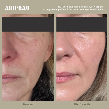 ADIPEAU  bundle 150 ml tube of Strength Gel & 60 ml tube of Volume Cream.