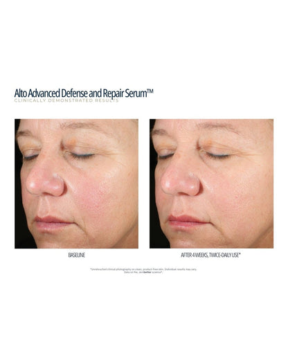 SkinBetter Science Alto Advanced Defense & Repair Serum