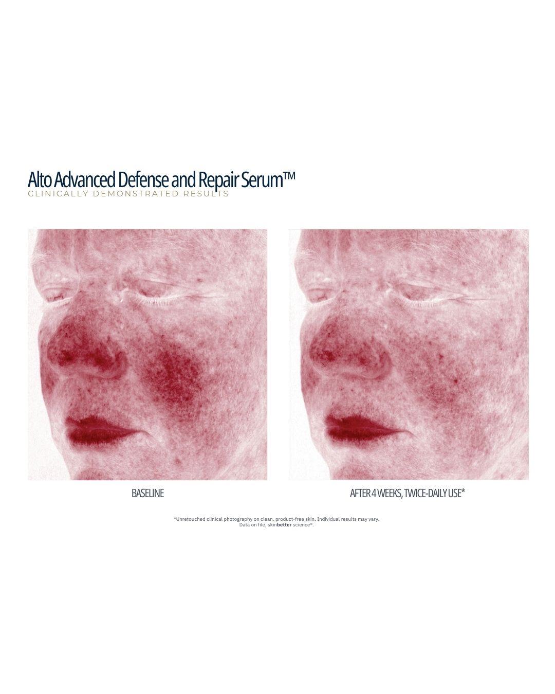 SkinBetter Science Alto Advanced Defense & Repair Serum