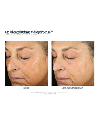 SkinBetter Science Alto Advanced Defense & Repair Serum