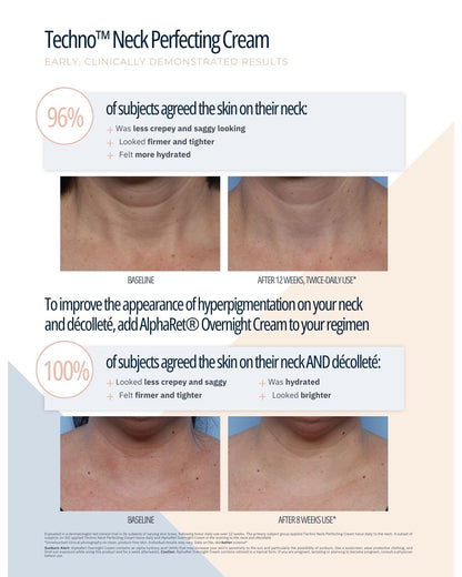 SkinBetter Science® Techno™ Neck Perfecting Cream