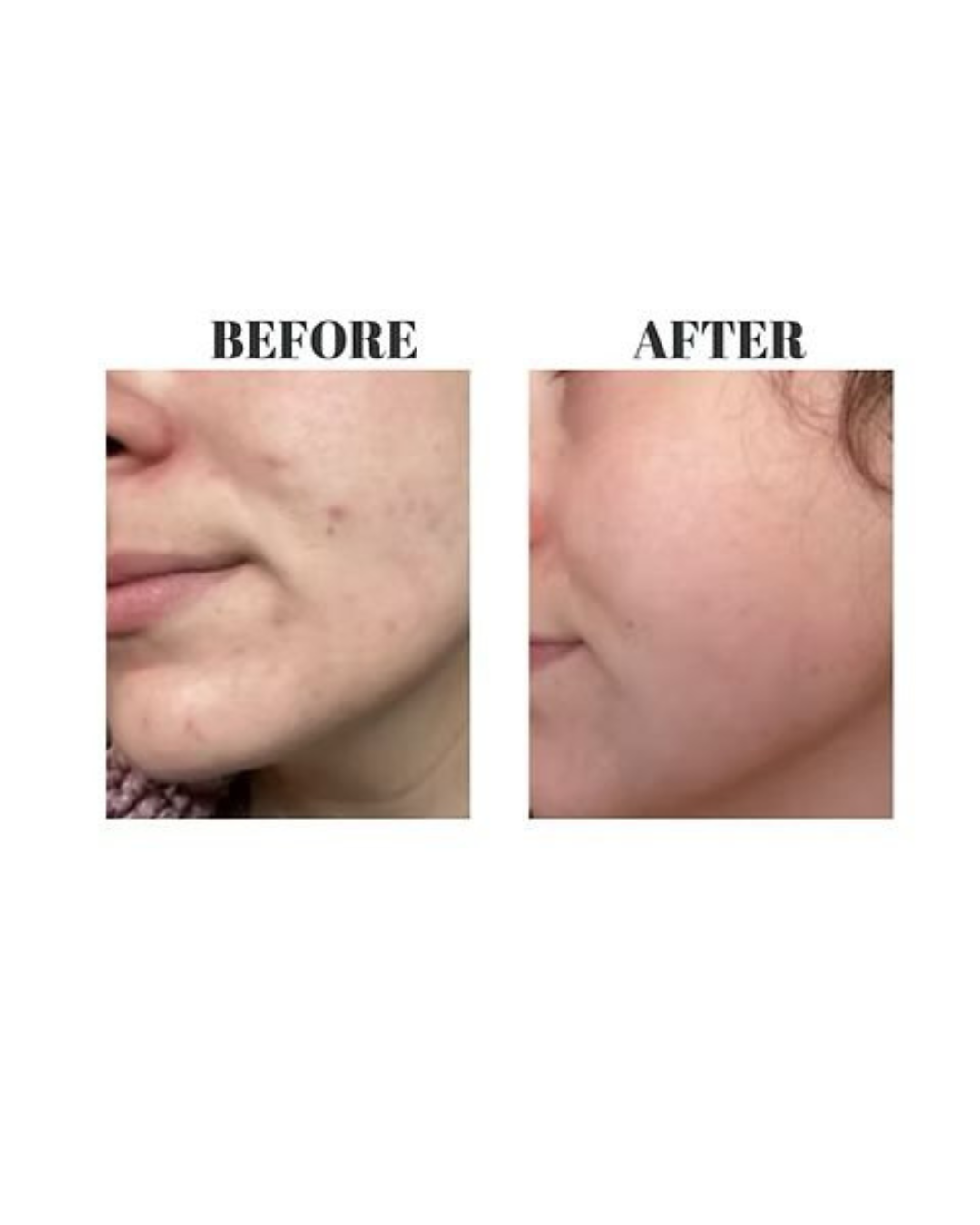 SIV Biome Balancing Serum