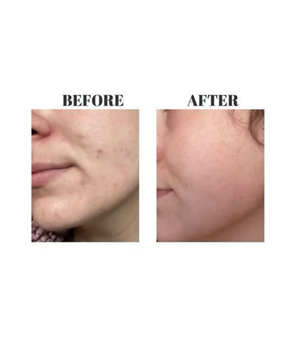 SIV Biome Balancing Serum