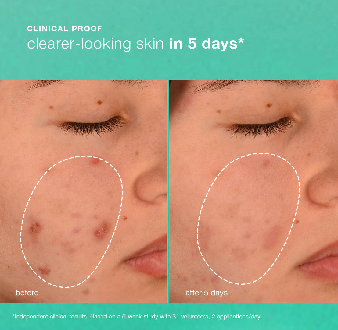 Breakout biotic moisturiser