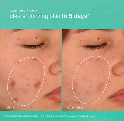Breakout biotic moisturiser