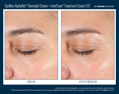 Skinbetter Science® EyeMax™ AlphaRet® Overnight EYE Cream