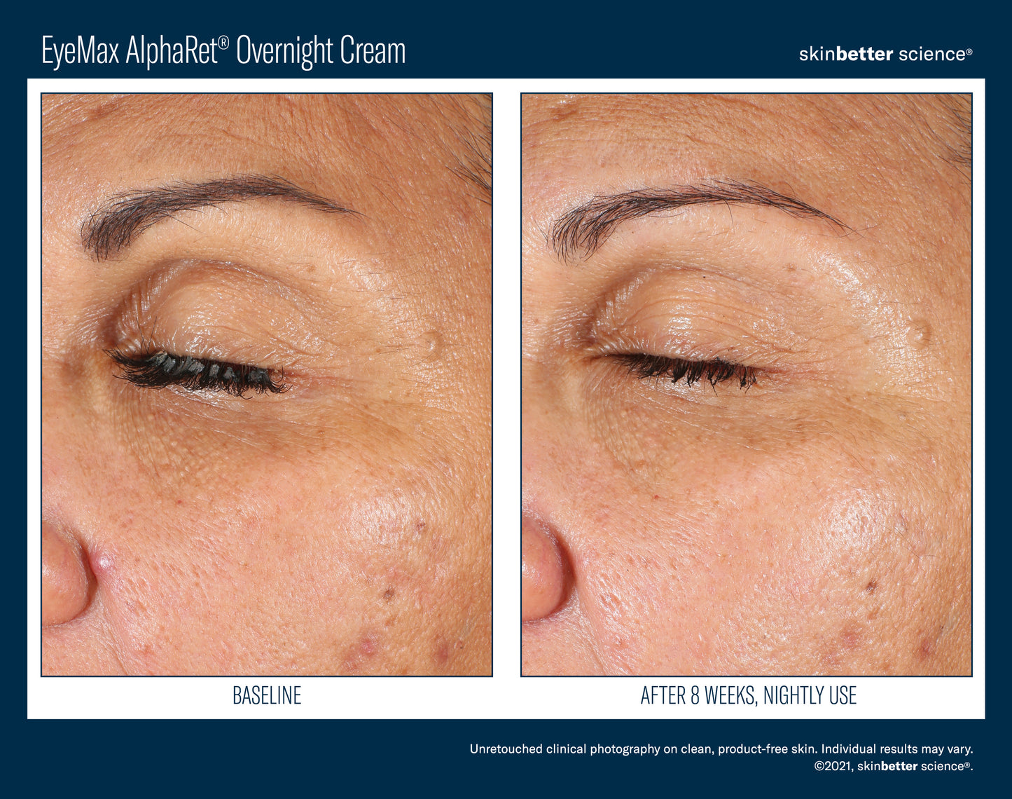 Skinbetter Science® EyeMax™ AlphaRet® Overnight EYE Cream
