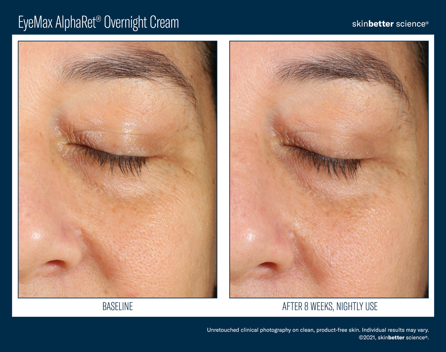 Skinbetter Science® EyeMax™ AlphaRet® Overnight EYE Cream