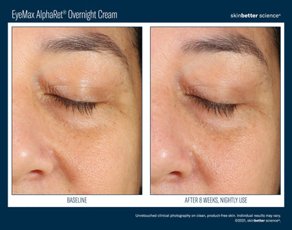 Skinbetter Science® EyeMax™ AlphaRet® Overnight EYE Cream