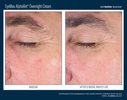 Skinbetter Science® EyeMax™ AlphaRet® Overnight EYE Cream