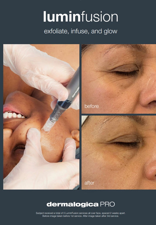 Dermalogica lumi infusion