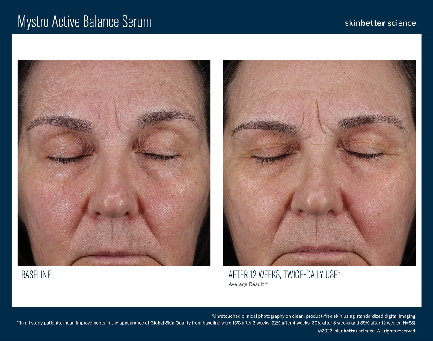 SkinBetter Science Mystro Active Balance Serum