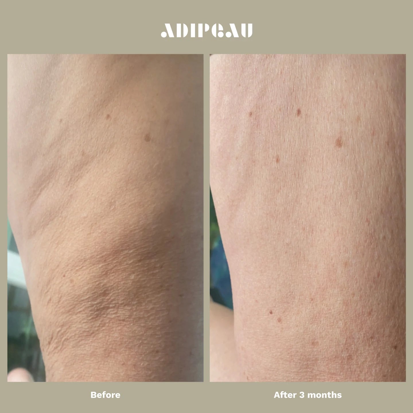 ADIPEAU Strength Gel