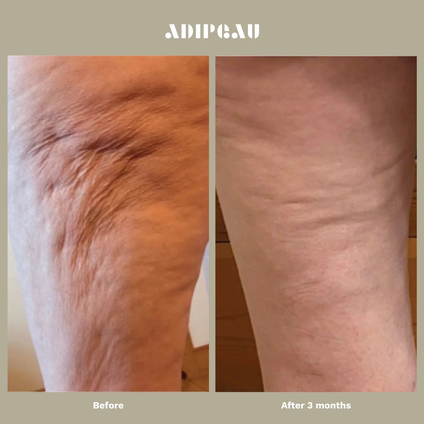 ADIPEAU  bundle 150 ml tube of Strength Gel & 60 ml tube of Volume Cream.