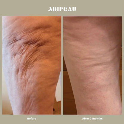 ADIPEAU  bundle 150 ml tube of Strength Gel & 60 ml tube of Volume Cream.