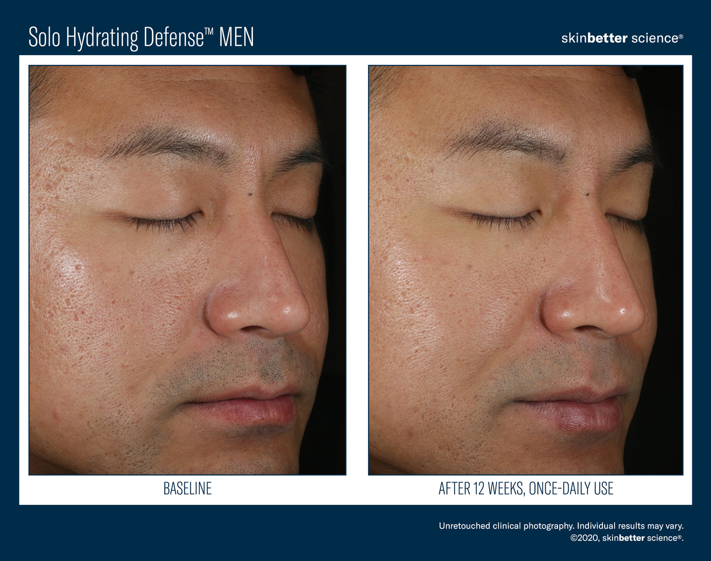 Skinbetter Science® Solo Hydrating Defense™ MEN