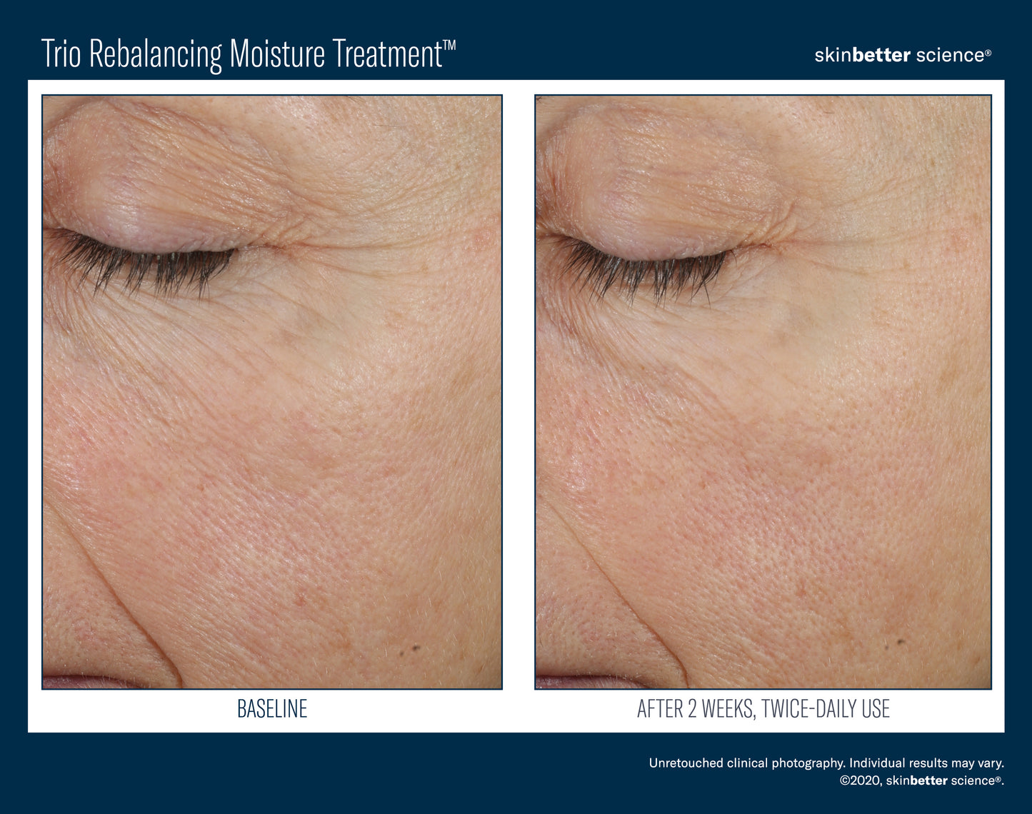 Skinbetter Science® Trio Rebalancing Moisture Treatment™