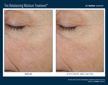 Skinbetter Science® Trio Rebalancing Moisture Treatment™