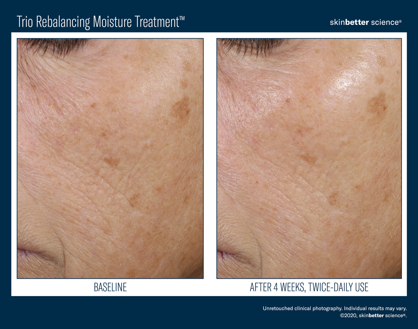 Skinbetter Science® Trio Rebalancing Moisture Treatment™