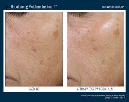 Skinbetter Science® Trio Rebalancing Moisture Treatment™