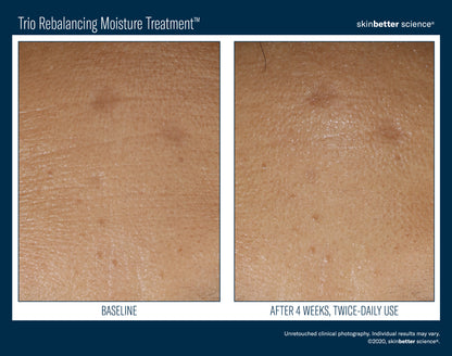Skinbetter Science® Trio Rebalancing Moisture Treatment™