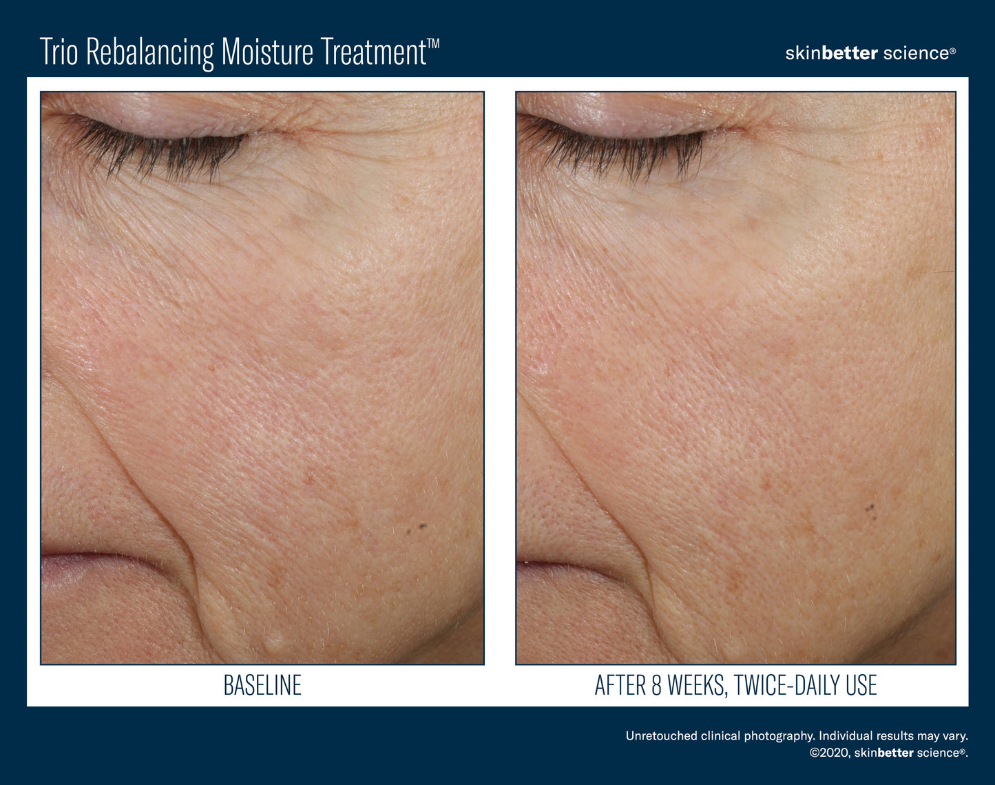 Skinbetter Science® Trio Rebalancing Moisture Treatment™