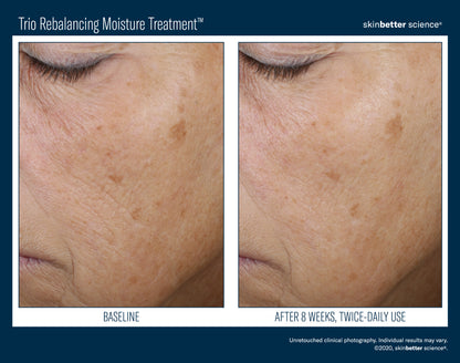 Skinbetter Science® Trio Rebalancing Moisture Treatment™