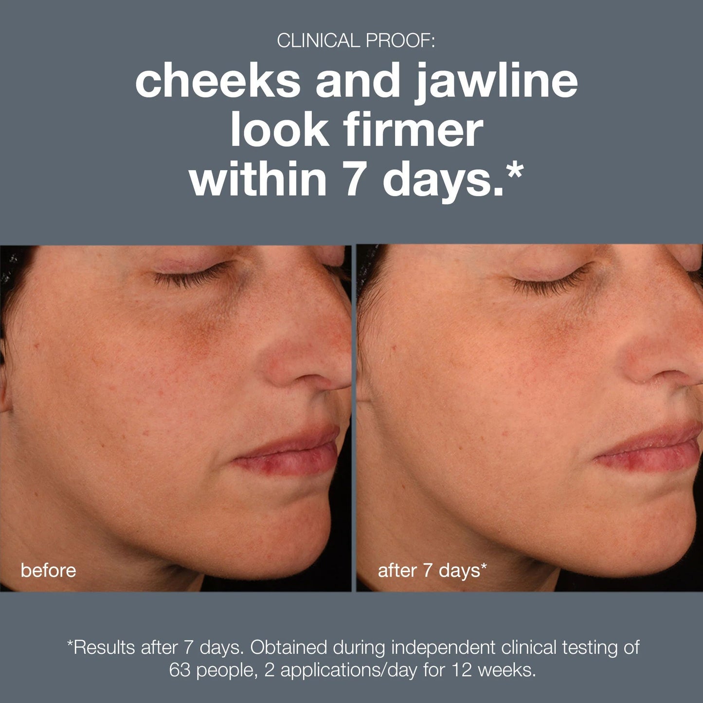 Biolumin-c night restore