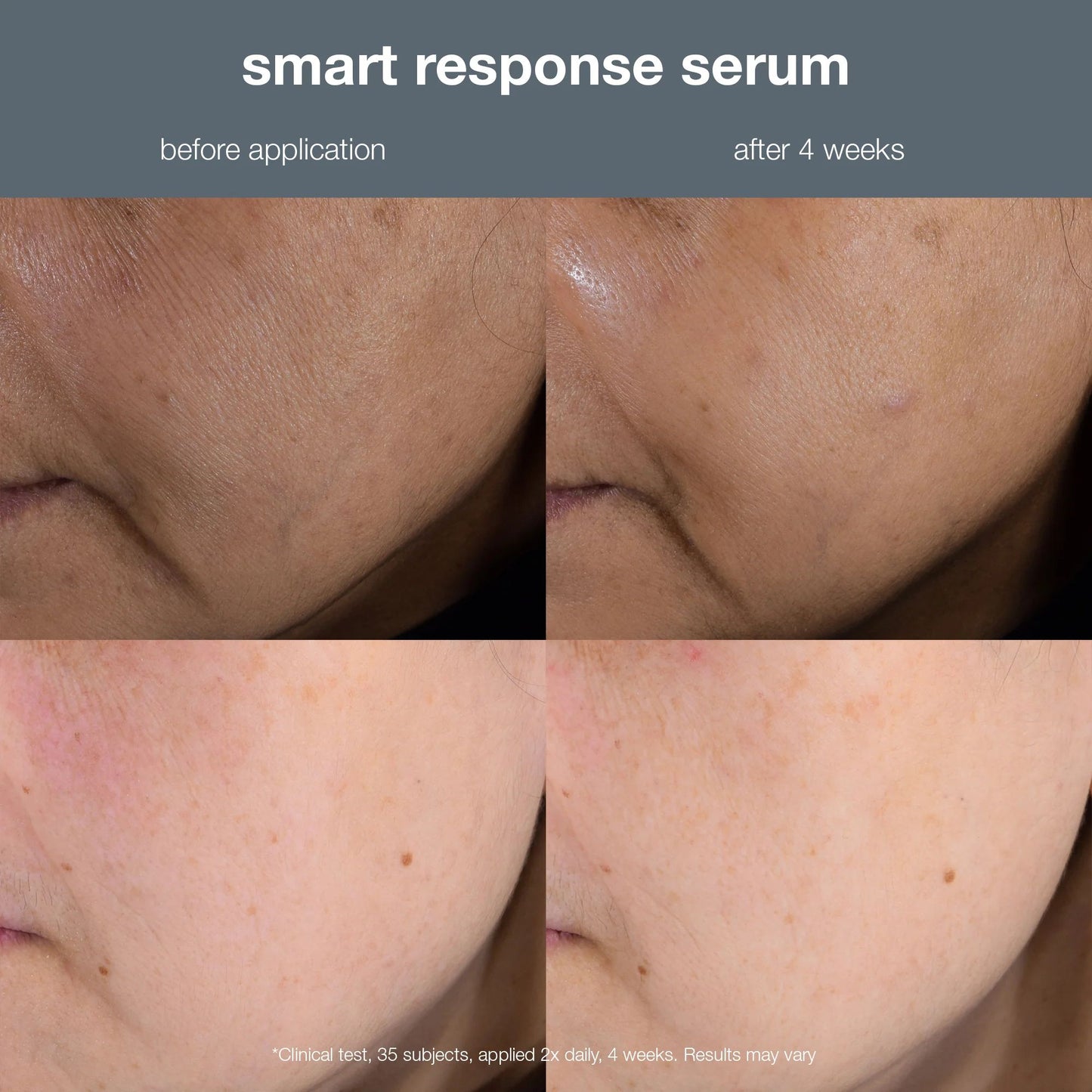 Smart response serum