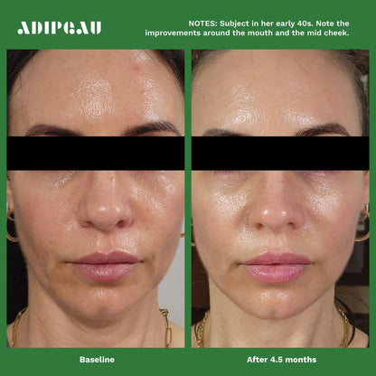 ADIPEAU  bundle 150 ml tube of Strength Gel & 60 ml tube of Volume Cream.