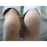 Footlogix Very Dry Skin Formula