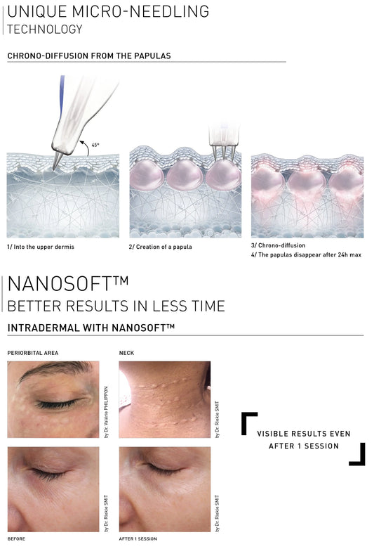 Mesotherapy Full face mappage and target work
