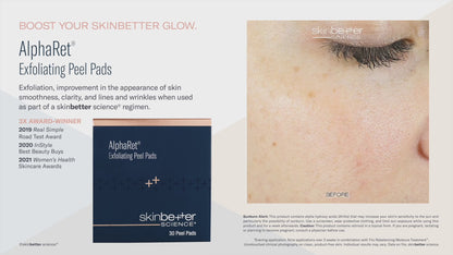 Skinbetter Science® Alpharet® Exfoliating Peel Pads