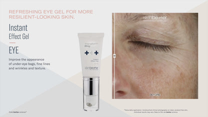 Skinbetter Science® Instant Effect Gel EYE