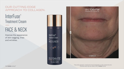 Skinbetter Science® Interfuse® Treatment Cream FACE and NECK