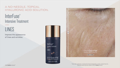 Skinbetter Science® Interfuse® Intensive Treatment LINES