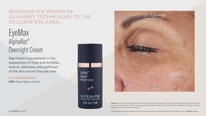 Skinbetter Science® EyeMax™ AlphaRet® Overnight EYE Cream